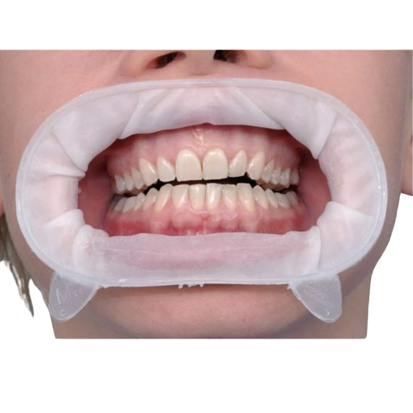 Optragate cheek retractor
